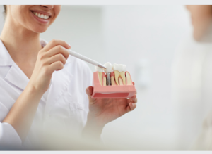 dental implants cost Adelaide